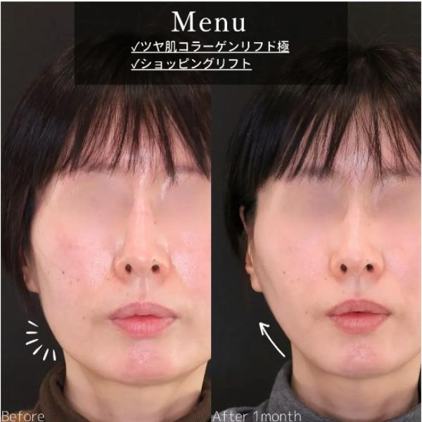 新宿TAクリニック_症例写真