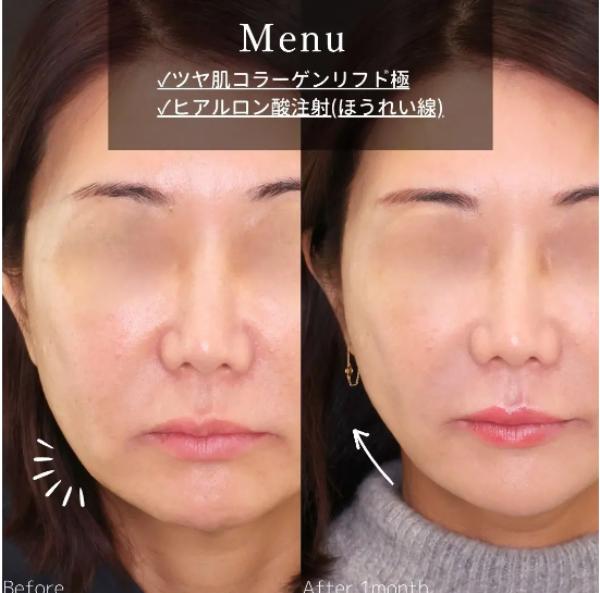 新宿TAクリニック_症例写真