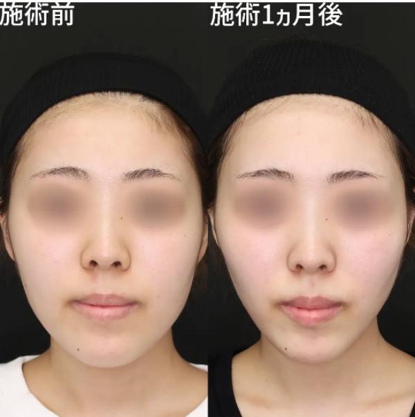 新宿TAクリニック_症例写真