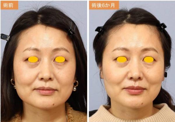 宮益坂クリニック_症例写真