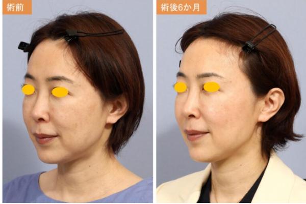 宮益坂クリニック_症例写真