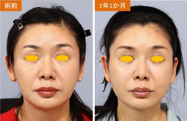 宮益坂クリニック_症例写真