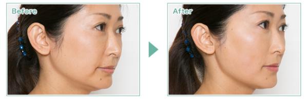 光伸メディカルクリニック_症例写真