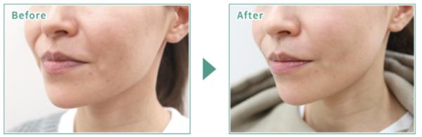 光伸メディカルクリニック_症例写真