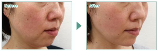 光伸メディカルクリニック_症例写真