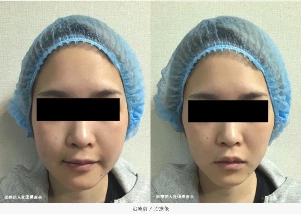 銀座よしえクリニック_症例写真