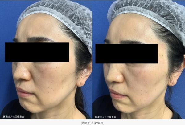 銀座よしえクリニック_症例写真