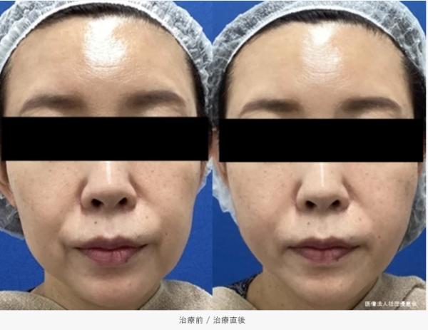 銀座よしえクリニック_症例写真