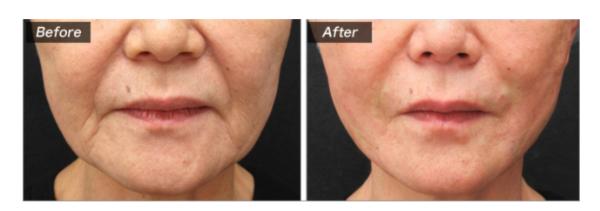 城本クリニック_症例写真