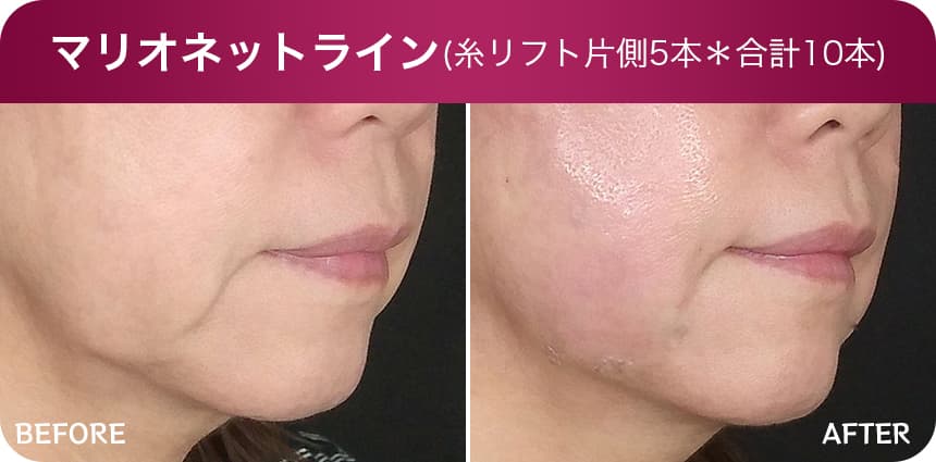 品川美容外科症例