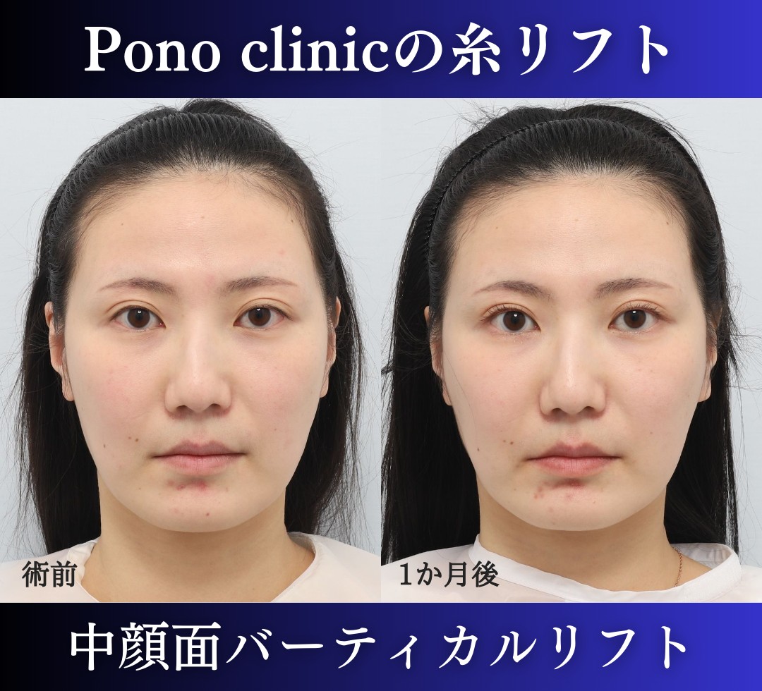  Pono clinic症例