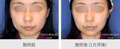 VENUS BEAUTY CLINIC症例