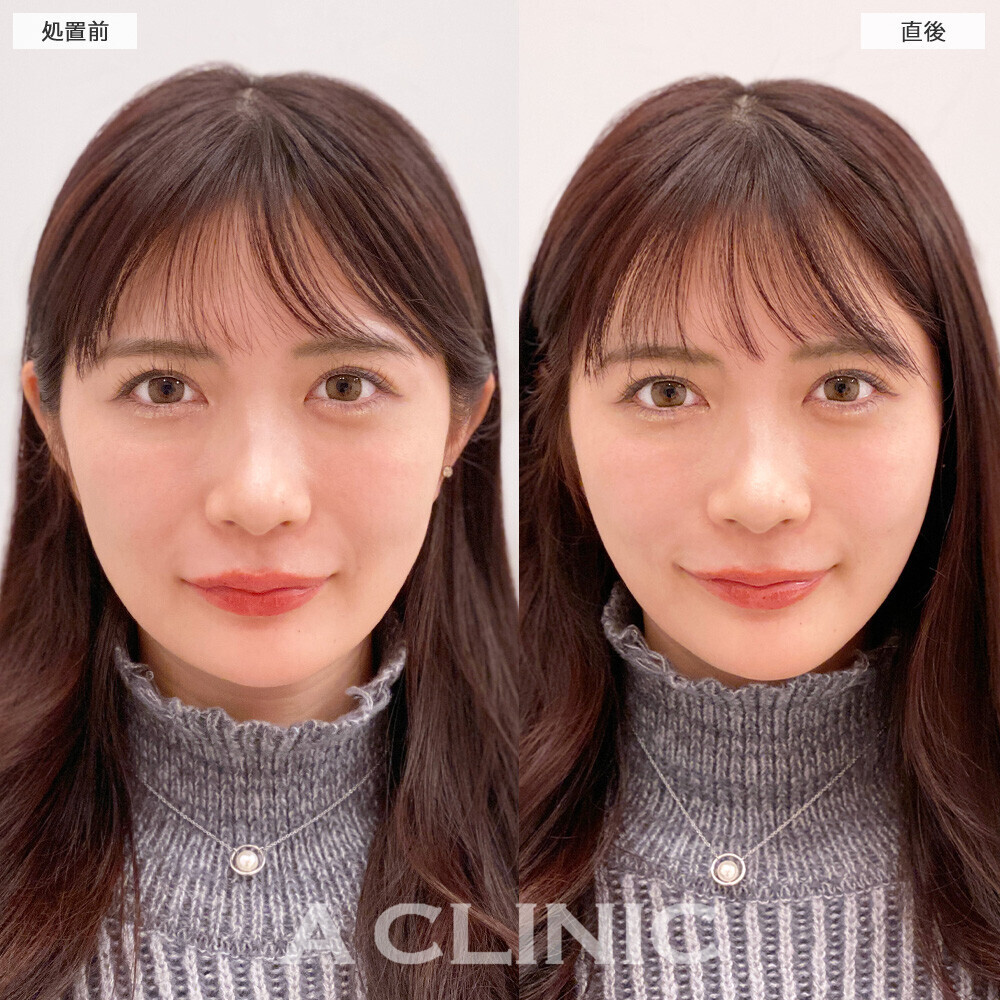 A CLINIC症例