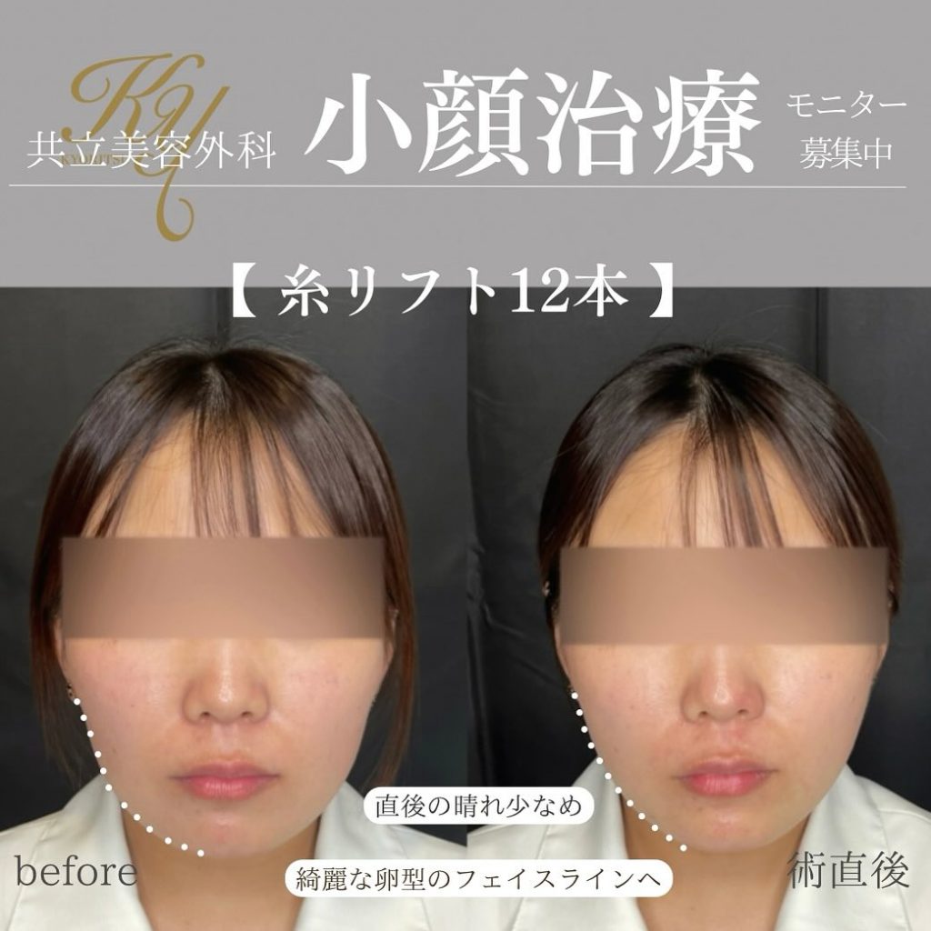共立美容外科症例