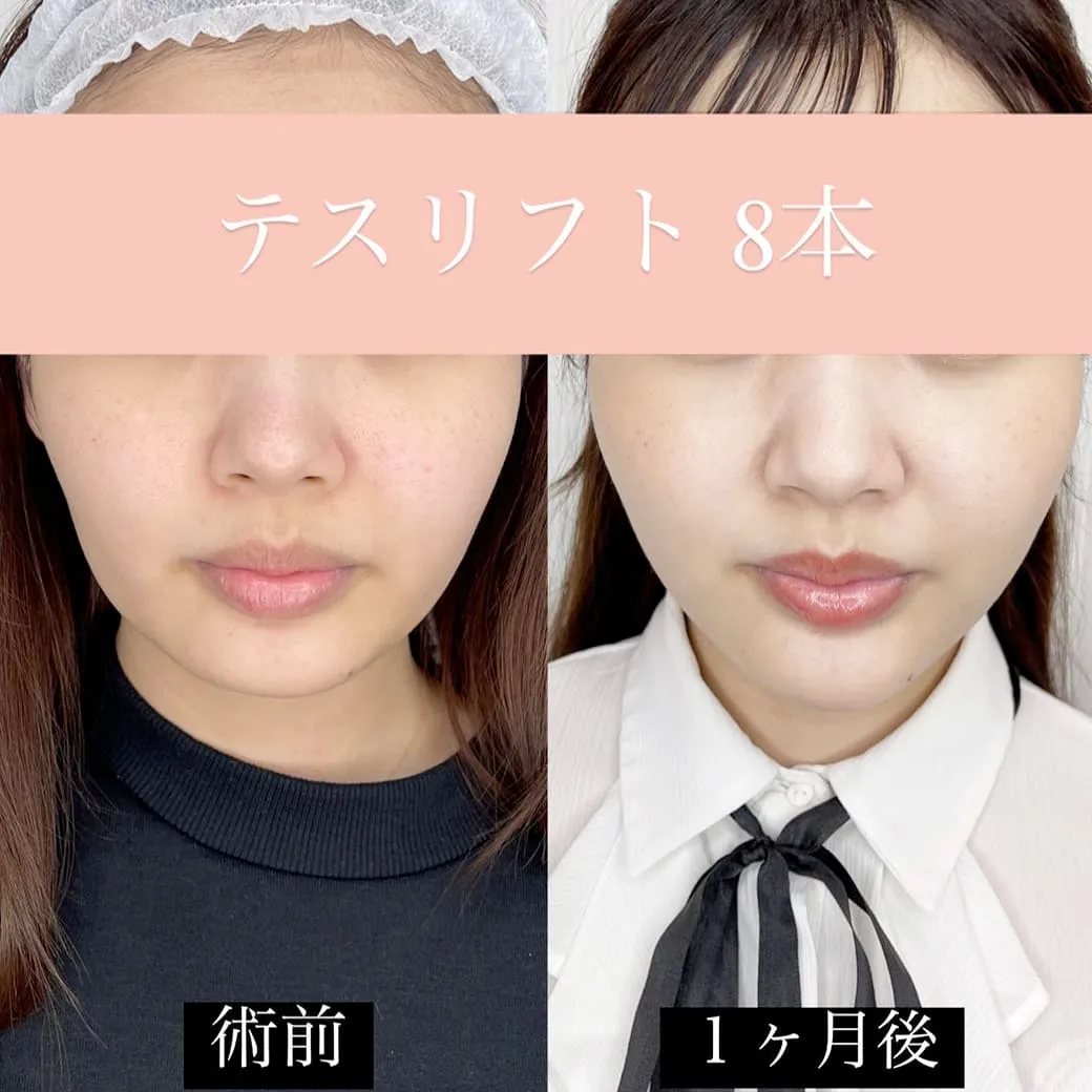 カンナム美容外科症例