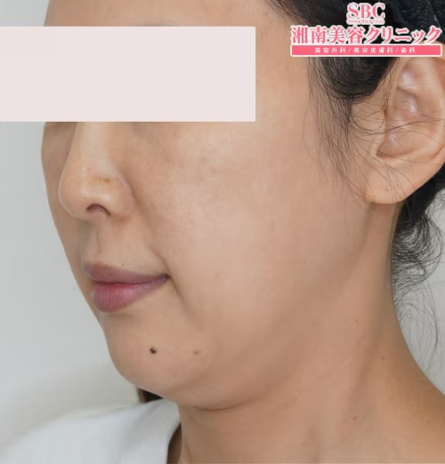 湘南美容クリニック_症例写真