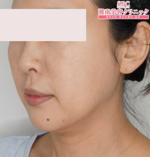 湘南美容クリニック_症例写真
