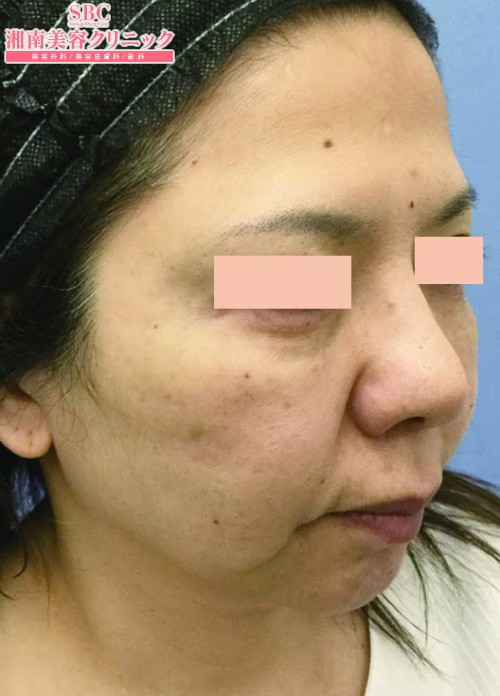 湘南美容クリニック_症例写真