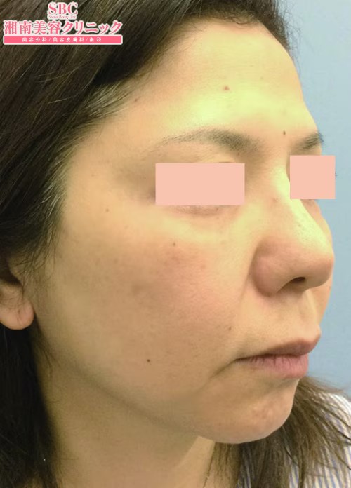 湘南美容クリニック_症例写真