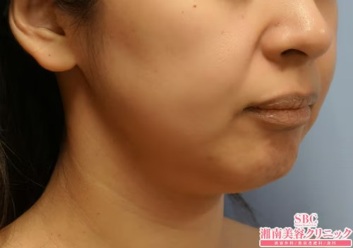 湘南美容クリニック_症例写真