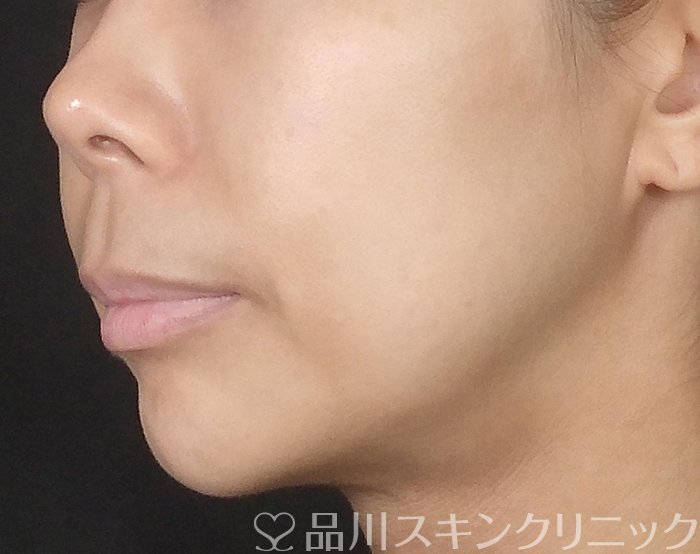 品川美容外科_症例写真