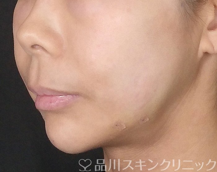 品川美容外科_症例写真