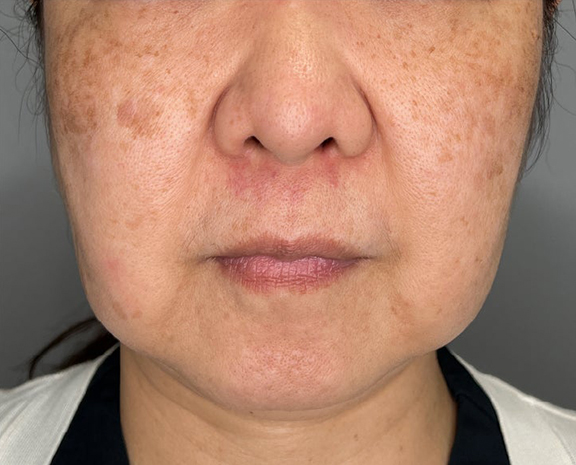 高須クリニック_症例写真