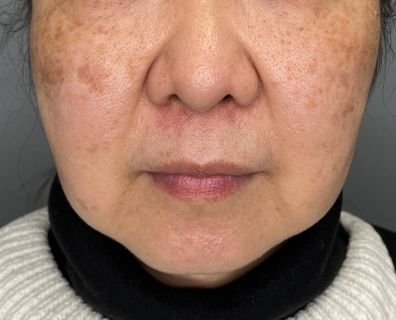 高須クリニック_症例写真