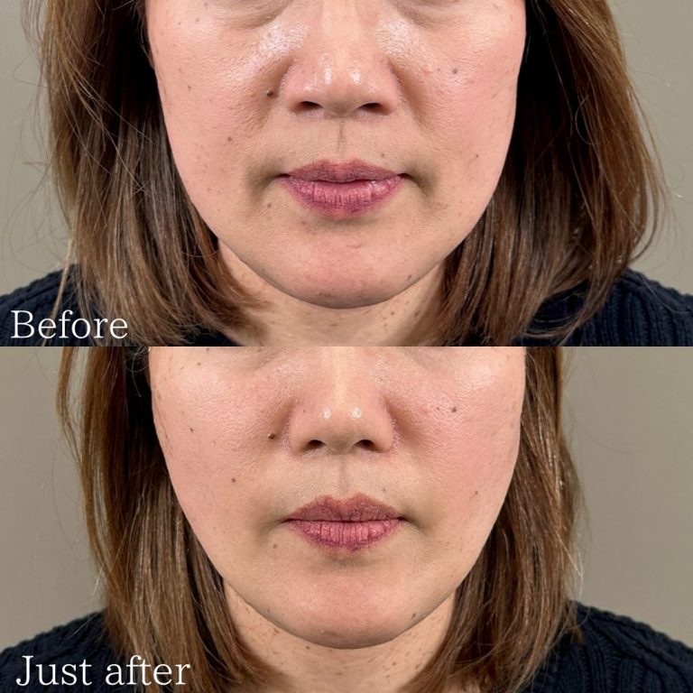 TCB東京中央美容外科_症例写真