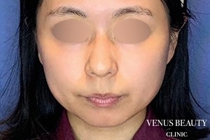 VENUS BEAUTY CLINIC_症例写真