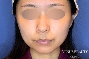 VENUS BEAUTY CLINIC_症例写真