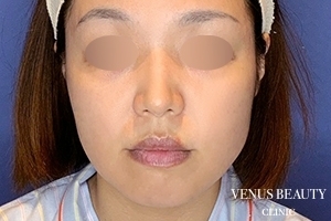 VENUS BEAUTY CLINIC_症例写真