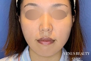 VENUS BEAUTY CLINIC_症例写真