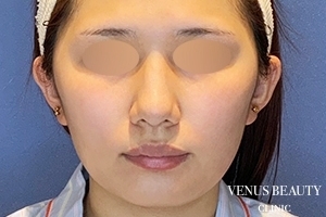 VENUS BEAUTY CLINIC_症例写真