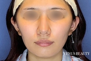 VENUS BEAUTY CLINIC_症例写真